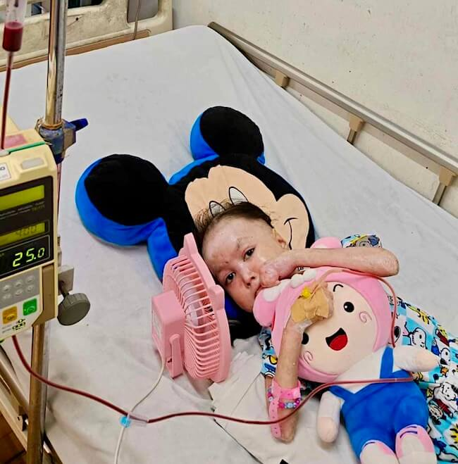 Shamila in a hospital bed receiving treatment